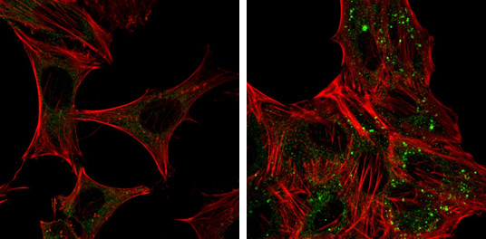 ATG12 Antibody in Immunocytochemistry (ICC/IF)