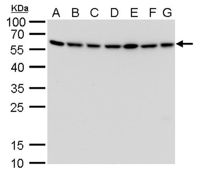 ATG12 Antibody in Western Blot (WB)