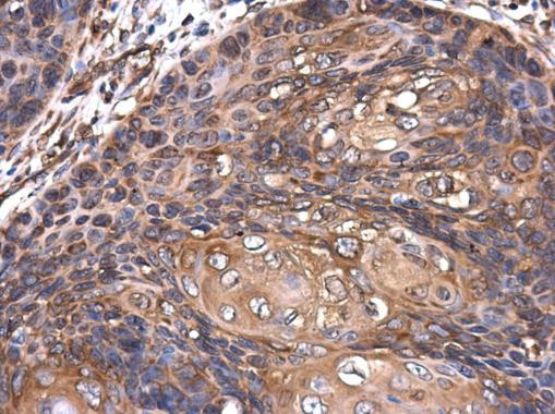 ROCK2 Antibody in Immunohistochemistry (Paraffin) (IHC (P))