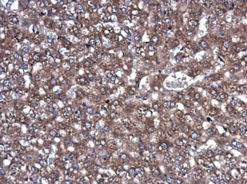 ROCK2 Antibody in Immunohistochemistry (Paraffin) (IHC (P))