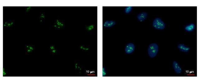 PAF49 Antibody in Immunocytochemistry (ICC/IF)