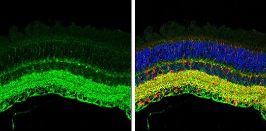 GAD67 Antibody in Immunohistochemistry (Paraffin) (IHC (P))