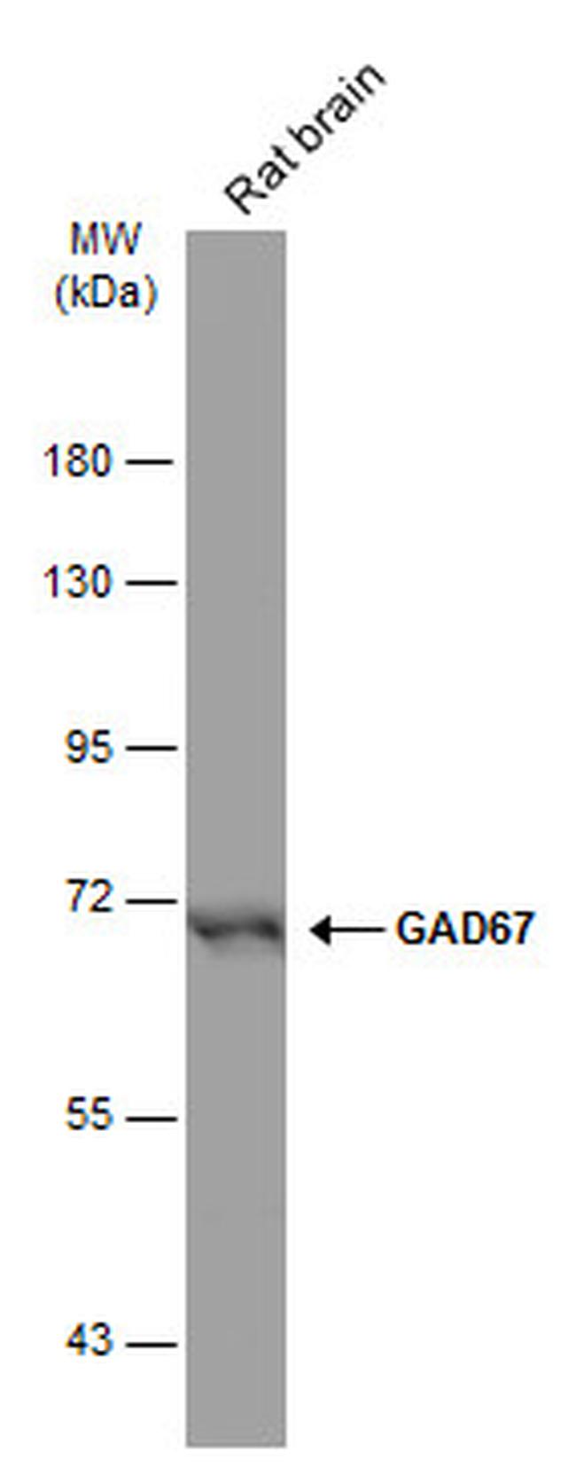 GAD67 Antibody in Western Blot (WB)