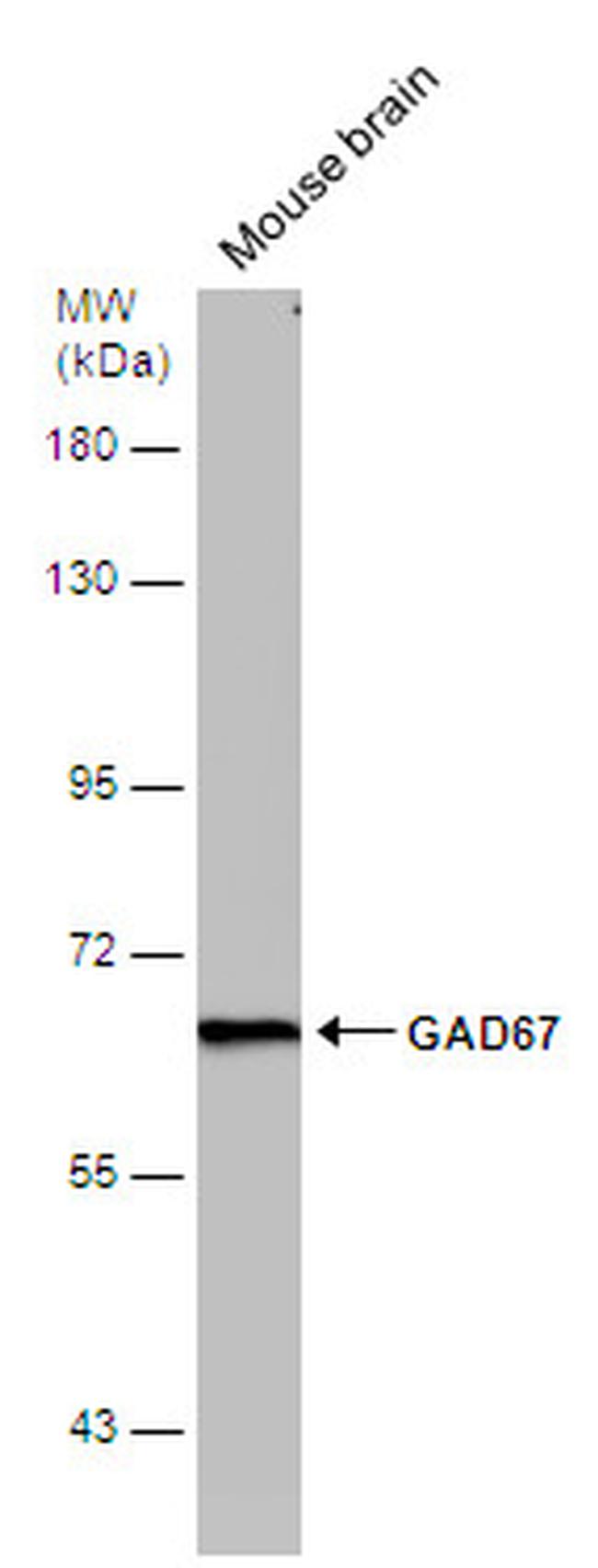 GAD67 Antibody in Western Blot (WB)