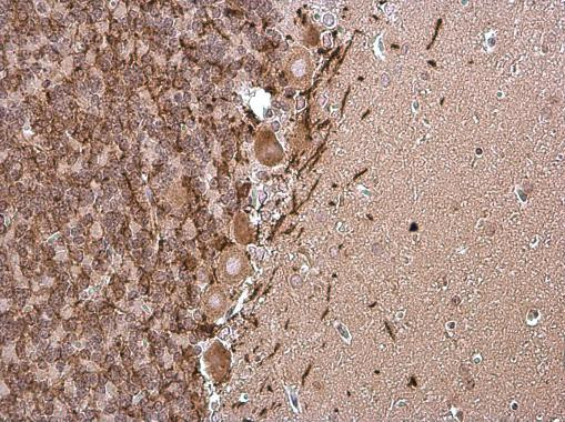 MBP Antibody in Immunohistochemistry (Paraffin) (IHC (P))