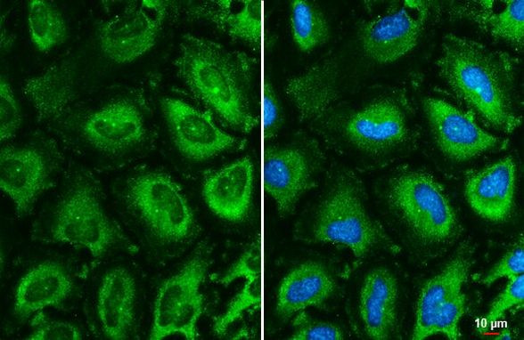 TCP-1 epsilon Antibody in Immunocytochemistry (ICC/IF)