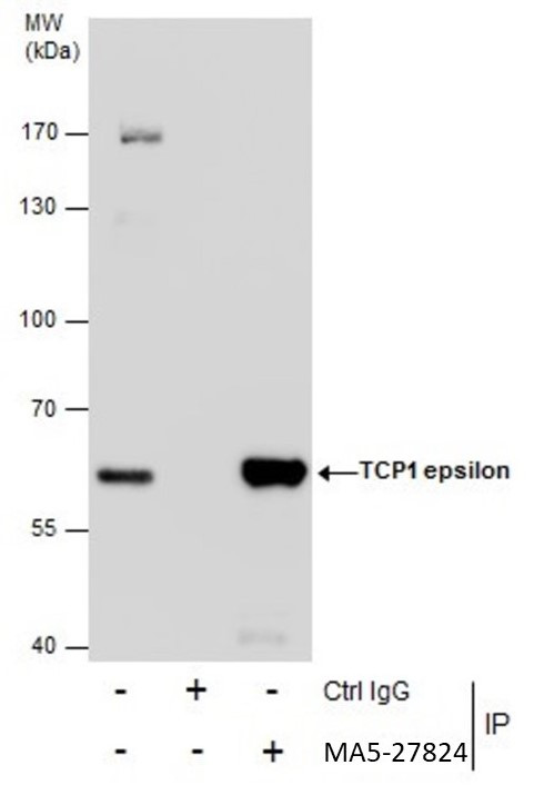 TCP-1 epsilon Antibody in Immunoprecipitation (IP)