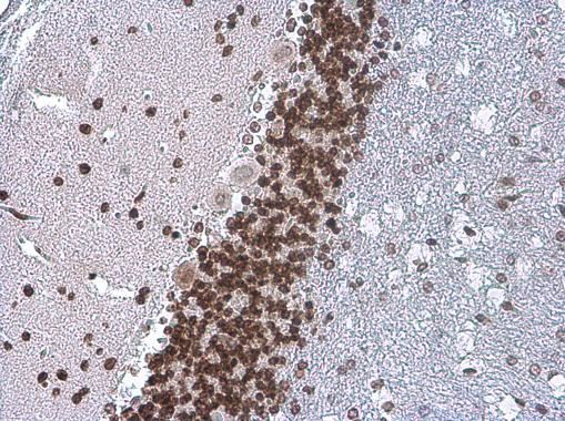 TDP-43 Antibody in Immunohistochemistry (Paraffin) (IHC (P))