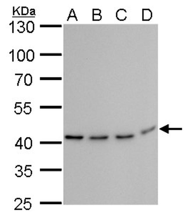 TDP-43 Antibody in Western Blot (WB)