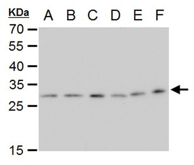 ETHE1 Antibody in Western Blot (WB)