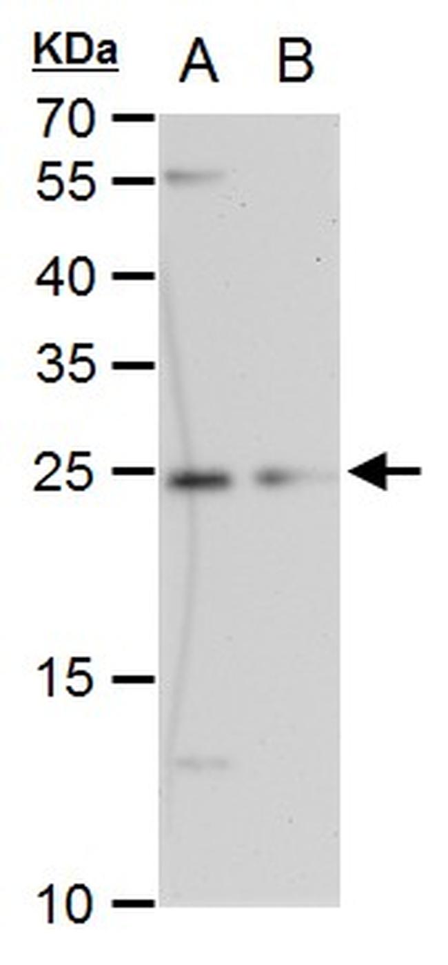 ETHE1 Antibody in Western Blot (WB)