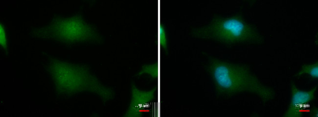 BABAM1 Antibody in Immunocytochemistry (ICC/IF)