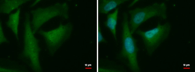 BABAM1 Antibody in Immunocytochemistry (ICC/IF)