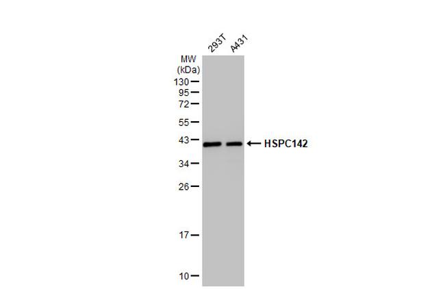 BABAM1 Antibody in Western Blot (WB)