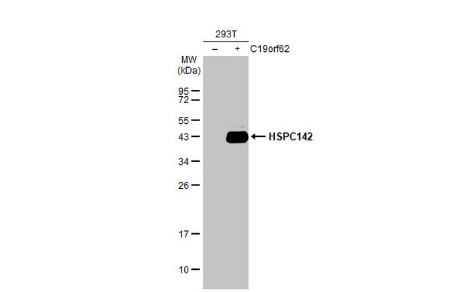 BABAM1 Antibody in Western Blot (WB)