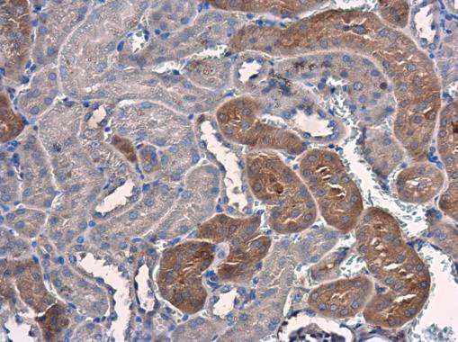 PSAT1 Antibody in Immunohistochemistry (Paraffin) (IHC (P))