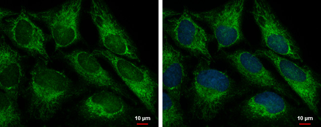 FIS1 Antibody in Immunocytochemistry (ICC/IF)