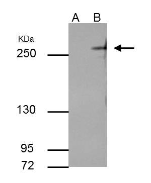 TET2 Antibody in Immunoprecipitation (IP)