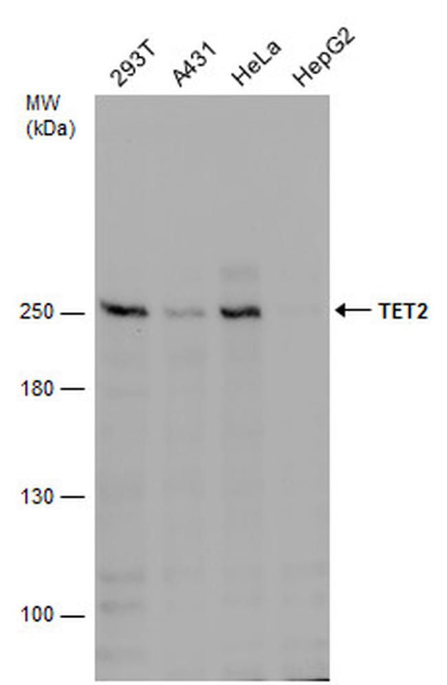 TET2 Antibody in Western Blot (WB)