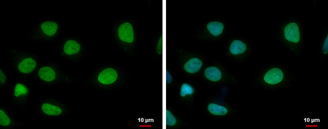 ELP3 Antibody in Immunocytochemistry (ICC/IF)