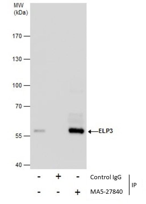 ELP3 Antibody in Immunoprecipitation (IP)