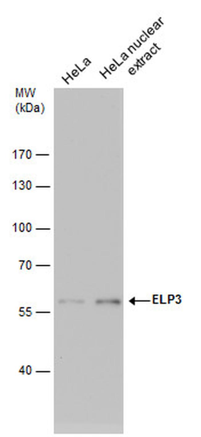 ELP3 Antibody in Western Blot (WB)