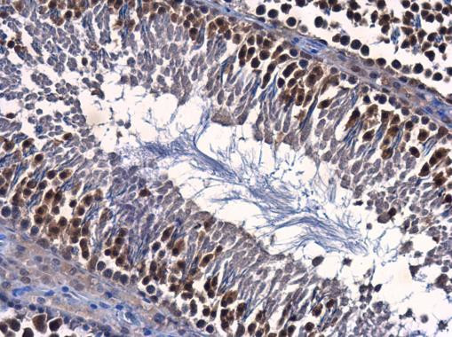 ENY2 Antibody in Immunohistochemistry (Paraffin) (IHC (P))