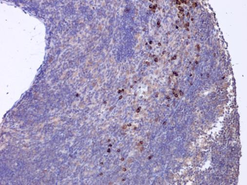 CXCL16 Antibody in Immunohistochemistry (Paraffin) (IHC (P))