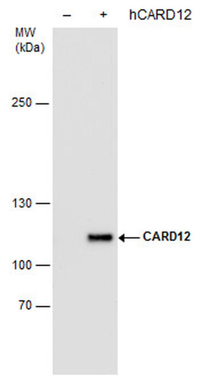 NLRC4 Antibody in Western Blot (WB)