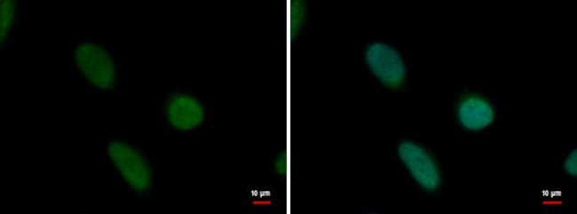 PRDM14 Antibody in Immunocytochemistry (ICC/IF)