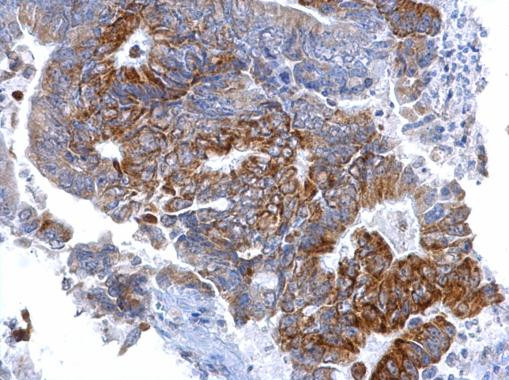 SETD6 Antibody in Immunohistochemistry (Paraffin) (IHC (P))