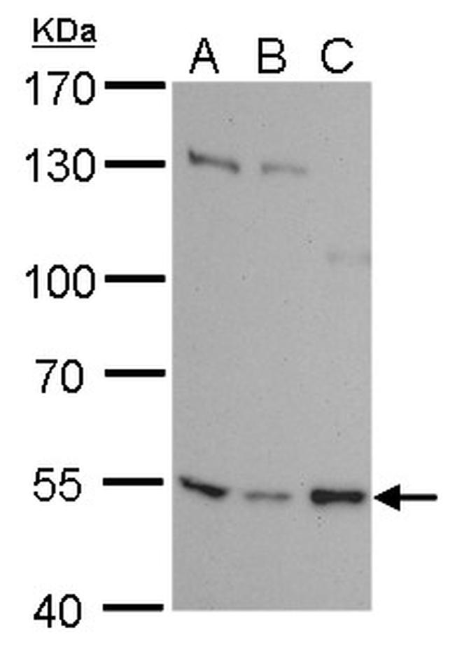 SETD6 Antibody in Western Blot (WB)