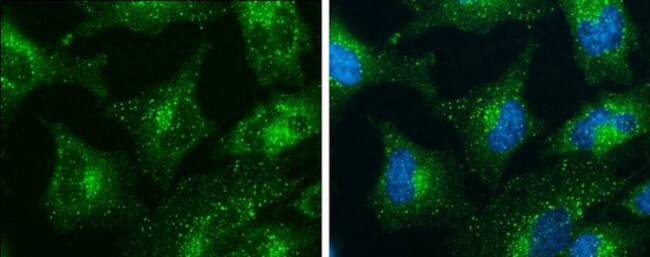 SNX27 Antibody in Immunocytochemistry (ICC/IF)