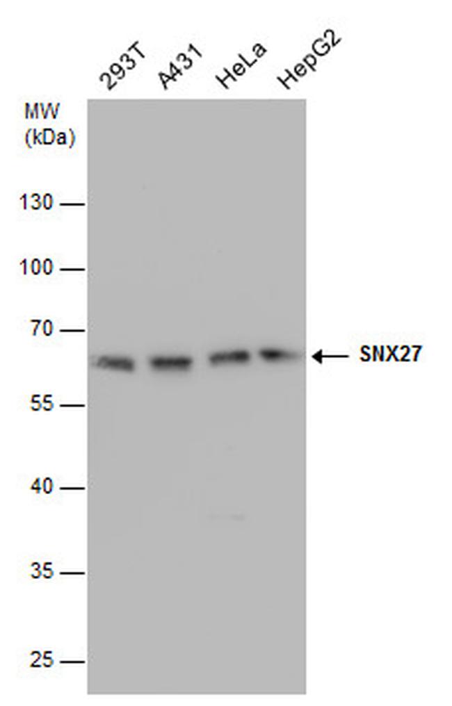 SNX27 Antibody in Western Blot (WB)