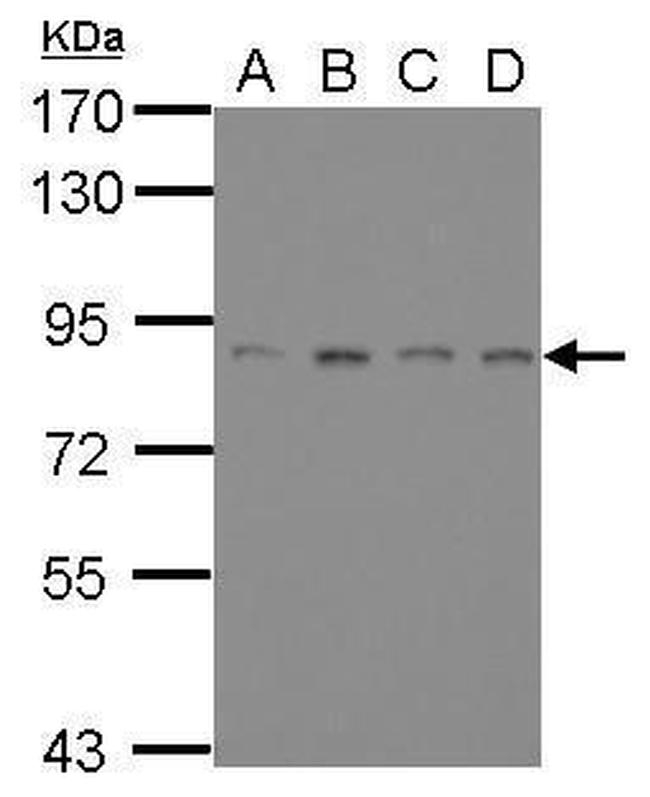 ATRIP Antibody in Western Blot (WB)