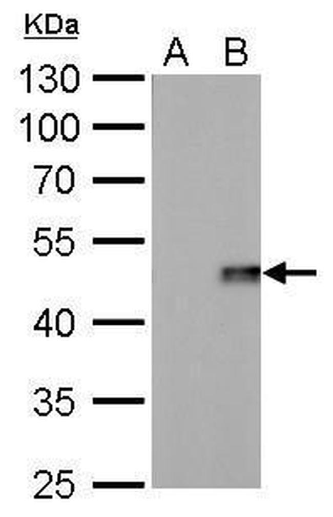 IL-28B Antibody in Western Blot (WB)