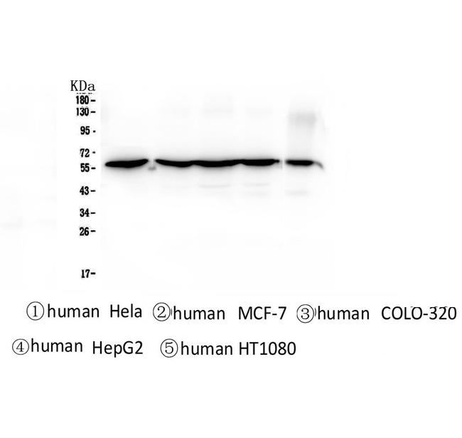 CCT3 Antibody in Western Blot (WB)