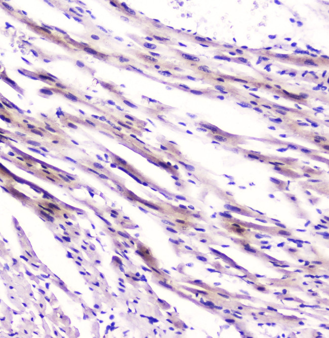 FABP3 Antibody in Immunohistochemistry (Paraffin) (IHC (P))