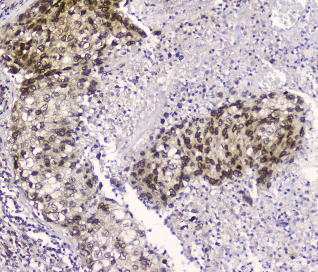 CRM1 Antibody in Immunohistochemistry (Paraffin) (IHC (P))