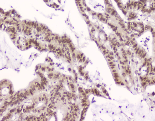 CRM1 Antibody in Immunohistochemistry (Paraffin) (IHC (P))