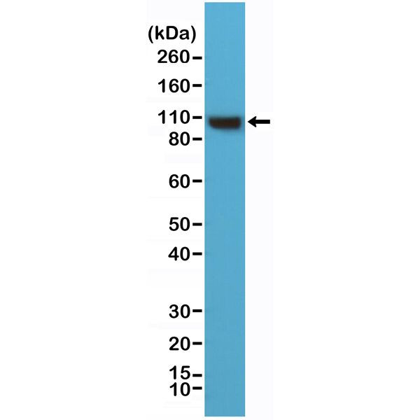 Alpha Actinin 4 Antibody in Western Blot (WB)