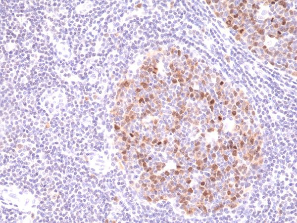 Aurora B Antibody in Immunohistochemistry (Paraffin) (IHC (P))