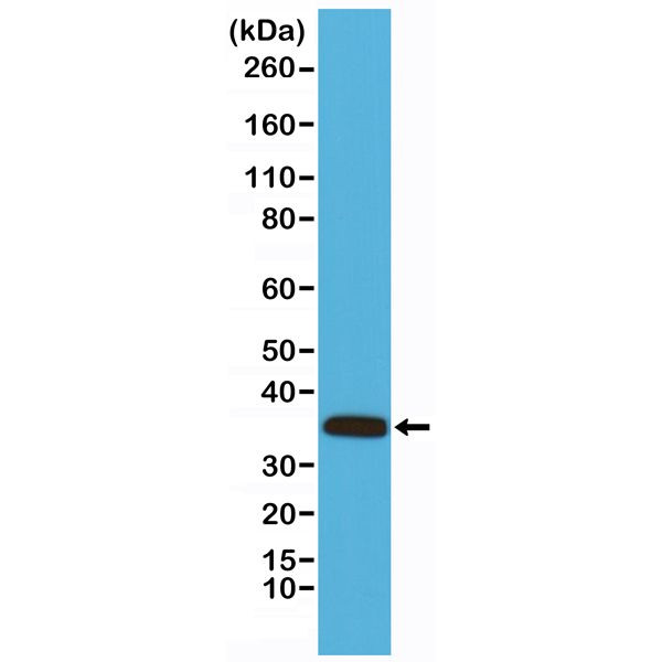 Calponin 1 Antibody in Western Blot (WB)