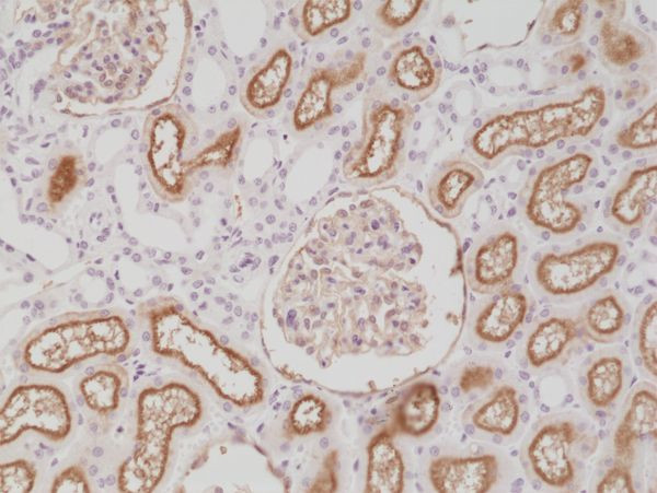 CD10 Antibody in Immunohistochemistry (Paraffin) (IHC (P))