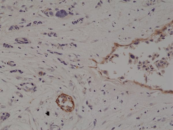 CD10 Antibody in Immunohistochemistry (Paraffin) (IHC (P))