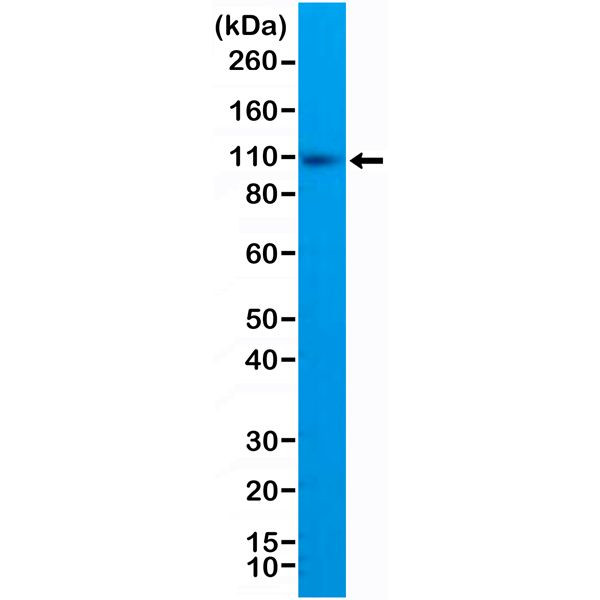 CD10 Antibody in Western Blot (WB)