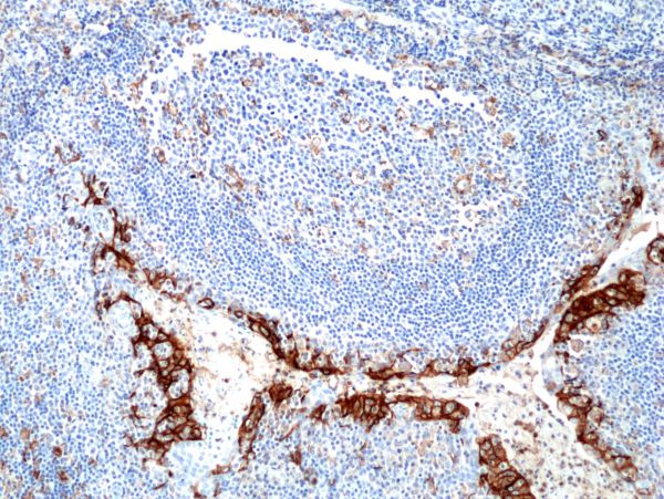 PD-L1 (CD274) Antibody in Immunohistochemistry (Paraffin) (IHC (P))