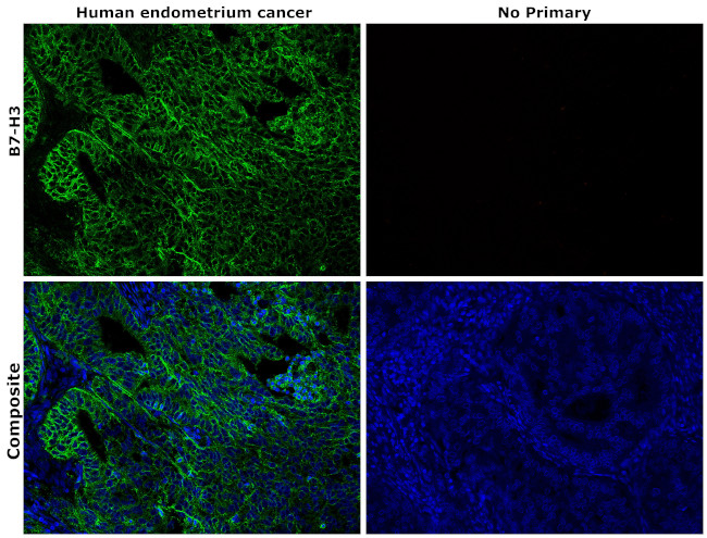 B7-H3 (CD276) Antibody in Immunohistochemistry (Paraffin) (IHC (P))