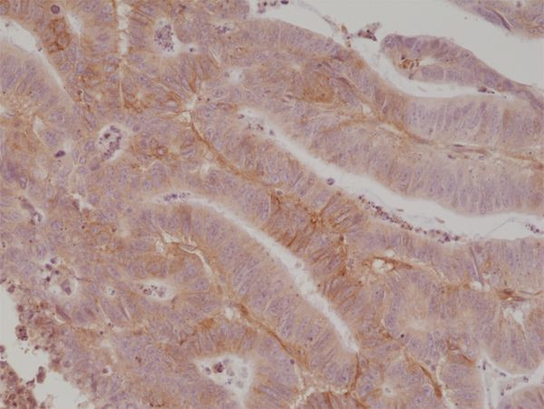 B7-H3 (CD276) Antibody in Immunohistochemistry (Paraffin) (IHC (P))