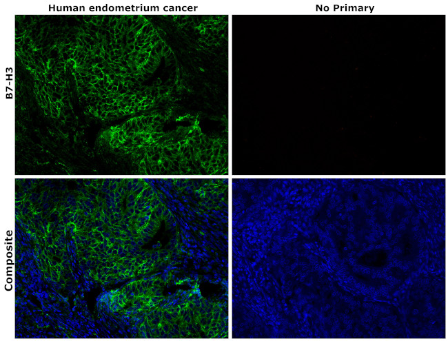 B7-H3 (CD276) Antibody in Immunohistochemistry (Paraffin) (IHC (P))